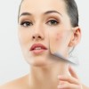 DERMA ROLLER mesoteraapia jaoks 192 titaannõeladega