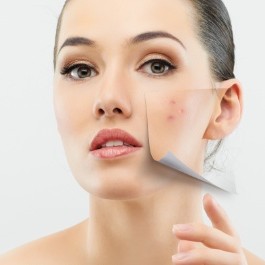 DERMA ROLLER mesoteraapia jaoks 192 titaannõeladega